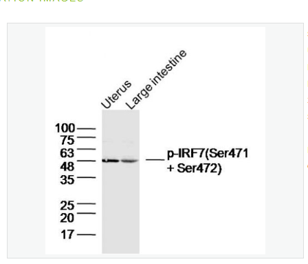 Anti-Phospho-IRF7  antibody-磷酸化干扰素调节因子7抗体,Phospho-IRF7 (Ser471 + Ser472)