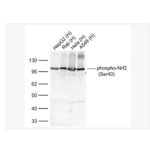 Anti-phospho-Nrf2- 磷酸化核因子2相关因子2(Ser40)重组兔单克隆抗体