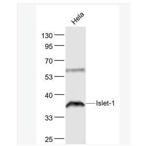 Anti-Islet-1 antibody- 胰岛素基因增强结合蛋白1抗体