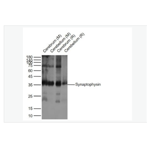 Anti-Synaptophysin antibody- 突触小泡蛋白P38重组兔单克隆抗体