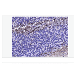 Anti-NF-L antibody- 低分子量神经丝蛋白单克隆抗体
