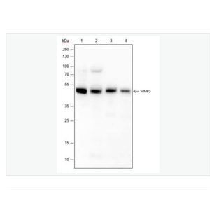 Anti-MMP3 antibody- 基质金属蛋白酶3重组兔单克隆抗体