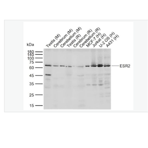 Anti-ESR2 antibody- 雌激素受体β抗体