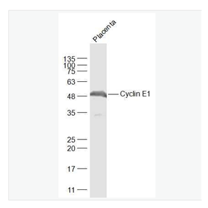 Anti-Cyclin E1 antibody-周期素E抗体