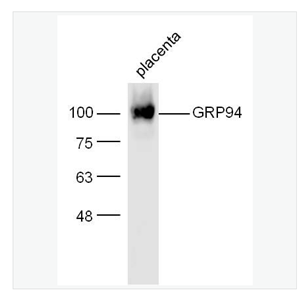 Anti-GRP94 antibody-葡萄糖调节蛋白94抗体