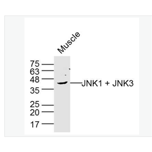 Anti-JNK1 + JNK3 antibody-氨基末端激酶1/3抗体
