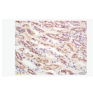 Anti-CDKN2A/p16-INK4a antibody-抑癌基因p16抗体