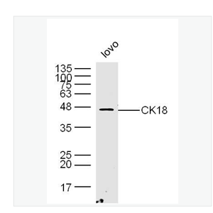 Anti-CK18 antibody-细胞角蛋白18抗体（C端）