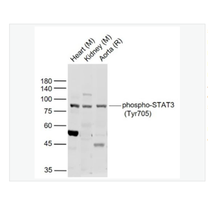 Anti-phospho-STAT3-磷酸化信号转导和转录激活因子3抗体