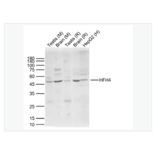 Anti-HFH4 antibody-叉头蛋白J1抗体,HFH4