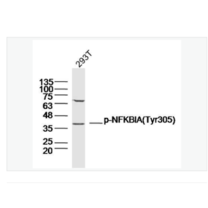 Anti- phospho-IKB alpha -磷酸化IKB alpha抗体,phospho-IKB alpha (Tyr305)