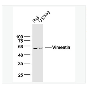 Anti-Vimentin antibody -波形蛋白单克隆抗体,Vimentin