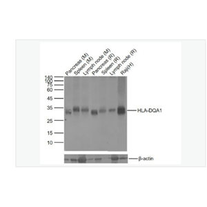 Anti-HLA-DQA1 antibody  -组织相容性抗原DQA1重组兔单克隆抗体