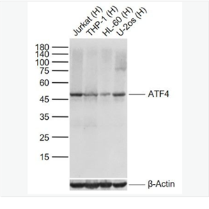 Anti-ATF4 antibody -活化转录因子4重组兔单克隆抗体