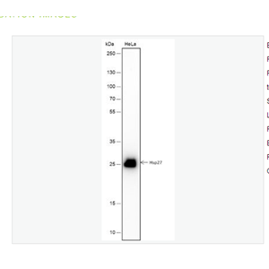 Anti-Hsp27 antibody -热休克蛋白27重组兔单克隆抗体