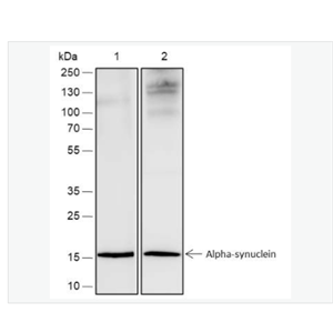 Anti-Alpha Synuclein antibody -核突触蛋白-α（N端）抗体