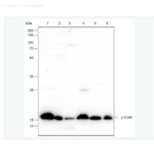 Anti-ARPC5 antibody -肌动蛋白相关蛋白2/3复合体亚基5重组兔单克隆抗体