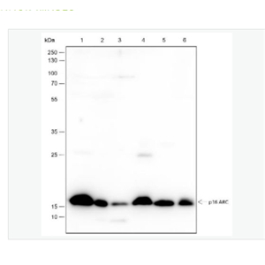 Anti-ARPC5 antibody -肌动蛋白相关蛋白2/3复合体亚基5重组兔单克隆抗体,ARPC5