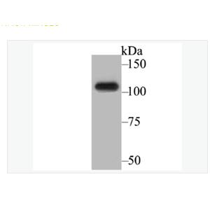 Anti-BRD2 antibody -BRD2蛋白重组兔单克隆抗体