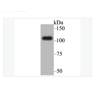 Anti-BRD2 antibody -BRD2蛋白重组兔单克隆抗体,BRD2