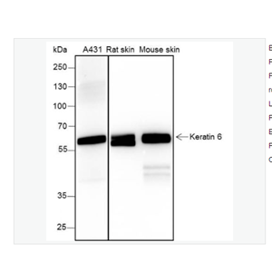 Anti-Keratin 6 antibody -细胞角蛋白6兔单克隆抗体,Keratin 6