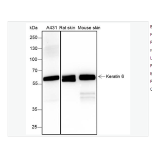 Anti-Keratin 6 antibody -細(xì)胞角蛋白6兔單克隆抗體,Keratin 6