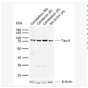Anti-Tau-4 antibody -人微管相关蛋白Tau-4单克隆抗体,Tau-4