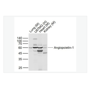 Anti-Angiopoietin-1 antibody -血管生成素-1抗体