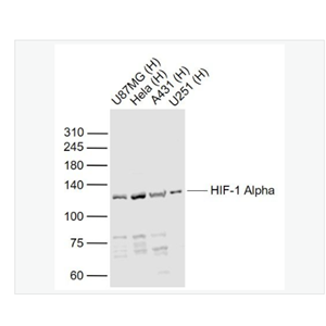 Anti-HIF-1 Alpha antibody -缺氧诱导因子1α /低氧诱导因子-1抗体
