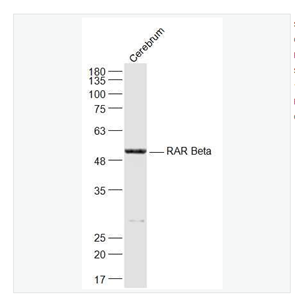 Anti-RARB antibody -维甲酸受体β抗体,RARB