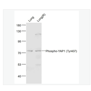 Anti-Phospho-YAP1-磷酸化原癌基因Yes相关蛋白1抗体