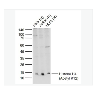 Anti-Histone H4 antibody -乙酰化组蛋白H4抗体,Histone H4 (Acetyl K12)