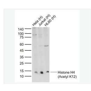 Anti-Histone H4 antibody -乙酰化組蛋白H4抗體