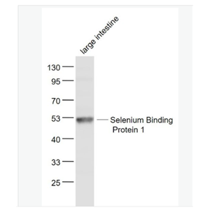 Anti-Selenium Binding Protein 1 antibody-硒结合蛋白1抗体,Selenium Binding Protein 1