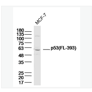 Anti-p53 (FL-393) antibody-肿瘤抑制基因p53抗体
