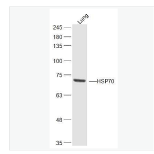 Anti-HSP70 antibody-热休克蛋白70抗体