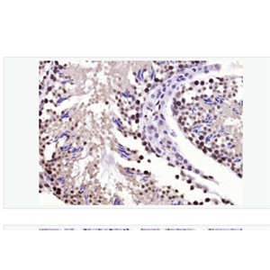 Anti-BPTF antibody-胎儿阿兹海默病抗原/核小体重塑因子抗体