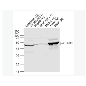 Anti-GPR30 antibody-G蛋白偶联受体30抗体