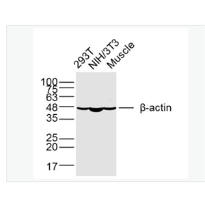 Anti-beta-Actin-β-肌动蛋白/β-Actin（内参）单克隆抗体