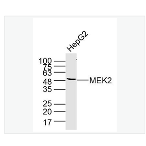 Anti-MEK2 antibody-丝裂原活化蛋白激酶激酶2单克隆抗体,MEK2
