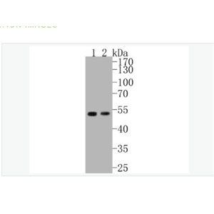 Anti-Cyclin E1 antibody-周期素E重组兔单克隆抗体,Cyclin E1