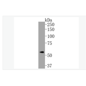 Anti-Phospho-Estrogen -磷酸化雌激素受体ER alpha 重组兔单克隆抗体,Phospho-Estrogen Receptor alpha (Ser118)