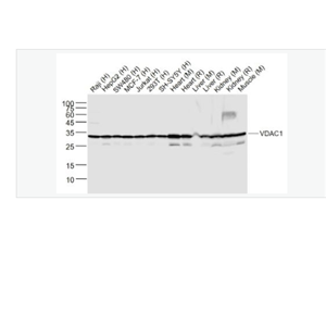Anti-VDAC1-等电压依赖性阴离子通道（内参）重组兔单克隆抗体
