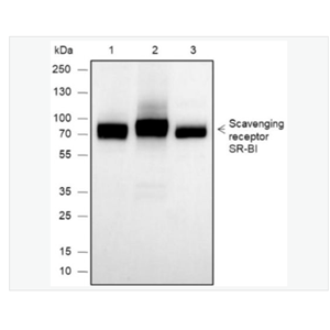 Anti-SCARB1-高密度脂蛋白受体/清道夫受体重组兔单克隆抗体