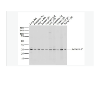 Anti-Annexin V antibody-重组膜粘连蛋白5抗体