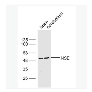Anti-HMGB1 antibody -神经元特异性烯醇化酶/γ 烯醇化酶抗体,NSE