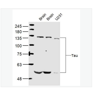 Anti-Tau antibody -微管相关蛋白抗体