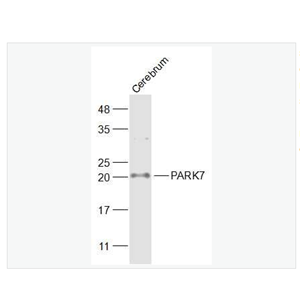 Anti-PARK7/DJ1 antibody -CAP1抗体,PARK7/DJ1