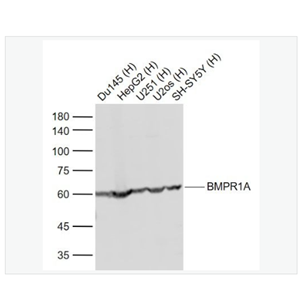 Anti-BMPR1A antibody -骨成型蛋白受体1A抗体