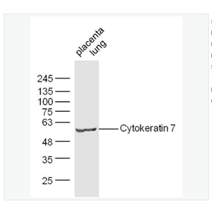 Anti-CK7 antibody-细胞角蛋白7抗体